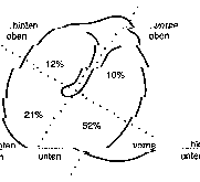 Aufteilung des Trommelfells  ECOMED Verlag